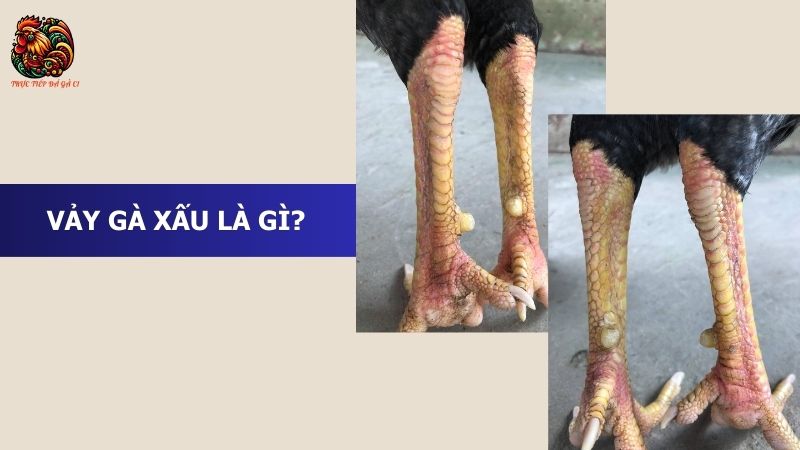 Vảy gà xấu là gì?